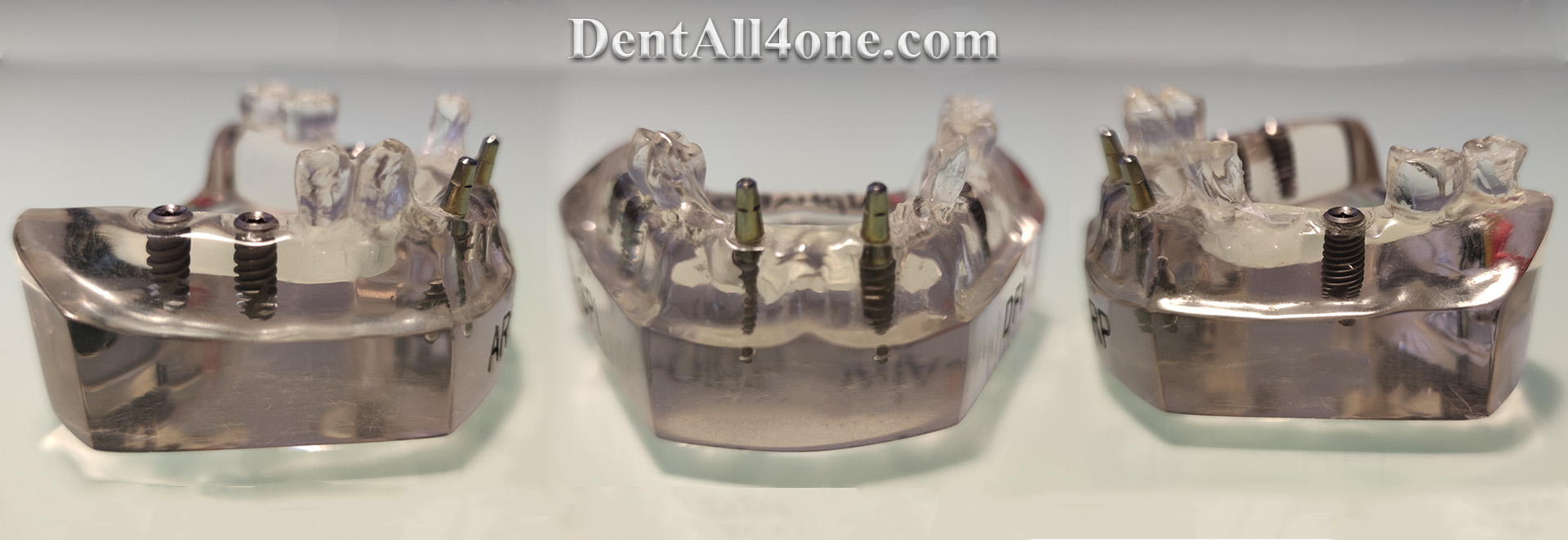 Implantat Alfa Bio - www.dentall4one.com